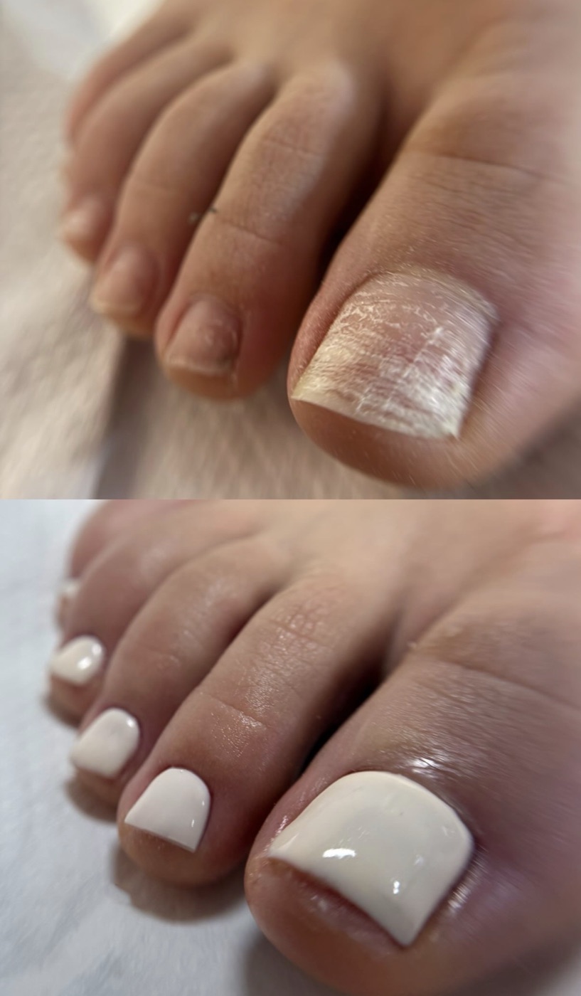 Pedicura semipermanente blanca cremosa — antes y después